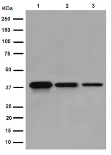 Western blot - Anti-NSDHL antibody [EPR14490] (AB190353)