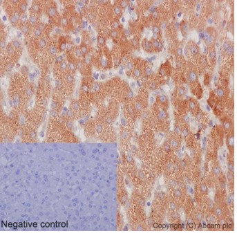Immunohistochemistry (Formalin/PFA-fixed paraffin-embedded sections) - Anti-NSDHL antibody [EPR14490] - BSA and Azide free (AB251016), expandable thumbnail