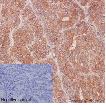 Immunohistochemistry (Formalin/PFA-fixed paraffin-embedded sections) - Anti-NSDHL antibody [EPR14490] - BSA and Azide free (AB251016), expandable thumbnail
