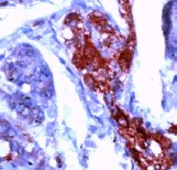 Immunohistochemistry (Formalin/PFA-fixed paraffin-embedded sections) - Anti-NSE antibody (AB15486)