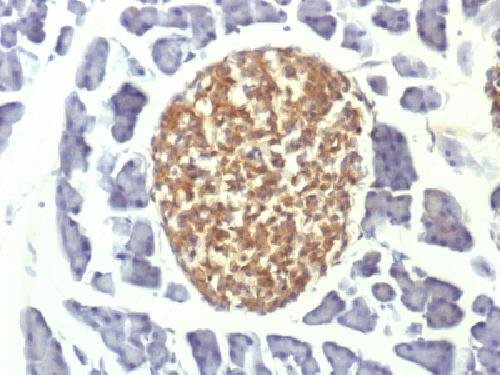 Immunohistochemistry (Formalin/PFA-fixed paraffin-embedded sections) - Anti-NSE antibody [ENO2/1375] - Neuronal Marker (AB218388), expandable thumbnail