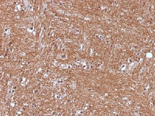 Immunohistochemistry (Formalin/PFA-fixed paraffin-embedded sections) - Anti-NSE antibody [ENO2/1375] (AB218388), expandable thumbnail