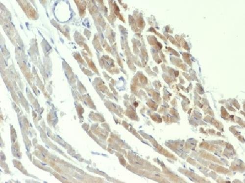 Immunohistochemistry (Formalin/PFA-fixed paraffin-embedded sections) - Anti-NSE antibody [ENO2/1375] (AB218388), expandable thumbnail