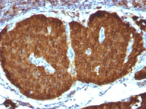 Immunohistochemistry (Formalin/PFA-fixed paraffin-embedded sections) - Anti-NSE antibody [ENO2/1375] (AB218388), expandable thumbnail