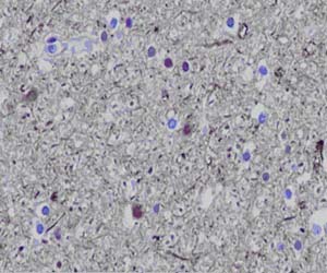 Immunohistochemistry (Formalin/PFA-fixed paraffin-embedded sections) - Anti-NSE antibody [EP12483-102] (AB189517), expandable thumbnail