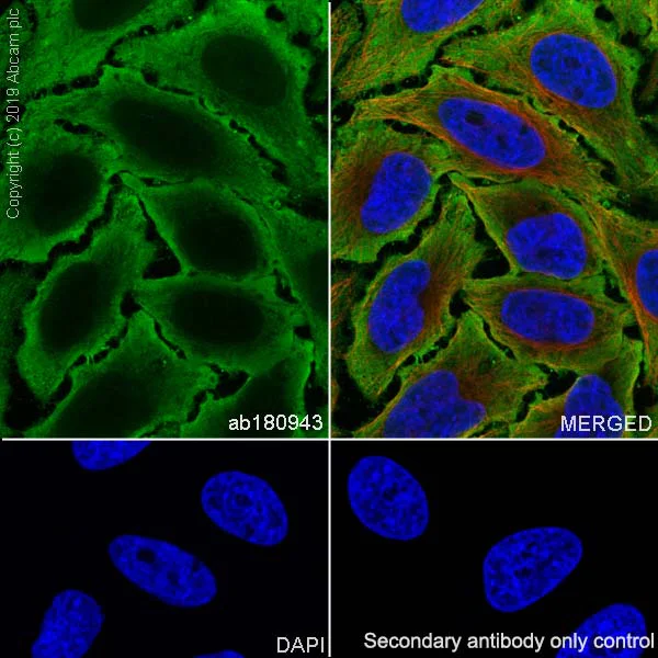 Immunocytochemistry/ Immunofluorescence - Anti-NSE antibody [EPR12483] - BSA and Azide free (AB250275)
