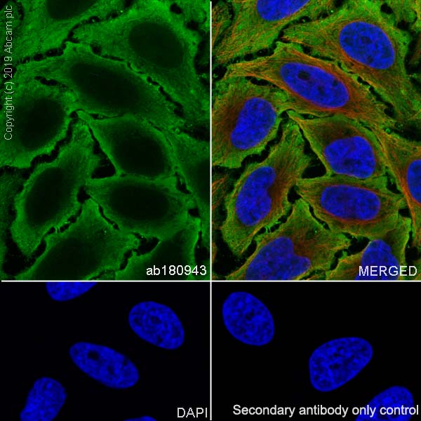 Immunocytochemistry/ Immunofluorescence - Anti-NSE antibody [EPR12483] (AB180943), expandable thumbnail