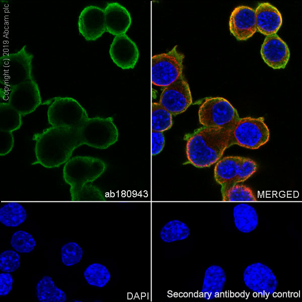 Immunocytochemistry/ Immunofluorescence - Anti-NSE antibody [EPR12483] (AB180943), expandable thumbnail
