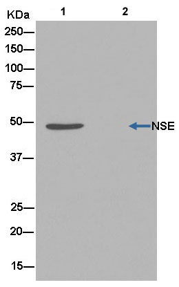 Immunoprecipitation - Anti-NSE antibody [EPR12483] - Neuronal Marker (AB180943), expandable thumbnail