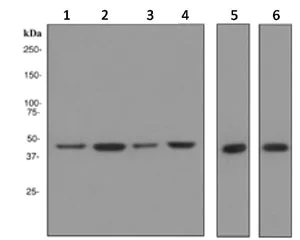 Western blot - Anti-NSE antibody [EPR3378] - Neuronal Marker (AB133309)