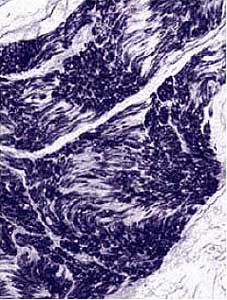 Immunohistochemistry (Formalin/PFA-fixed paraffin-embedded sections) - Anti-NSE antibody [NSE-P1] (AB24709), expandable thumbnail