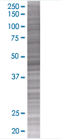 NSE overexpression 293T lysate (whole cell)