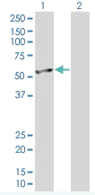 Western blot - NSE overexpression 293T lysate (whole cell) (AB94096)