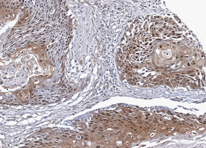 Immunohistochemistry (Formalin/PFA-fixed paraffin-embedded sections) - Anti-NSFL1C antibody (AB95963)