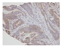 Immunohistochemistry (Formalin/PFA-fixed paraffin-embedded sections) - Anti-NSMAF antibody (AB96804)