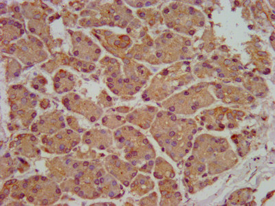 Immunohistochemistry (Formalin/PFA-fixed paraffin-embedded sections) - Anti-nSMase antibody (AB238568)