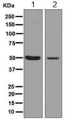 Western blot - Anti-nSMase antibody [EPR6718] (AB131330), expandable thumbnail