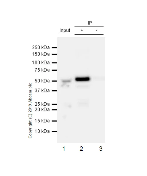 Immunoprecipitation - Anti-nSMase antibody [EPR6718] - BSA and Azide free (AB243913)