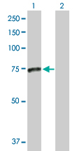Western blot - Anti-NSMase2 antibody (AB172793), expandable thumbnail