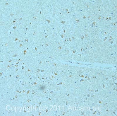 Immunohistochemistry (Formalin/PFA-fixed paraffin-embedded sections) - Anti-NSMase2 antibody (AB68735), expandable thumbnail