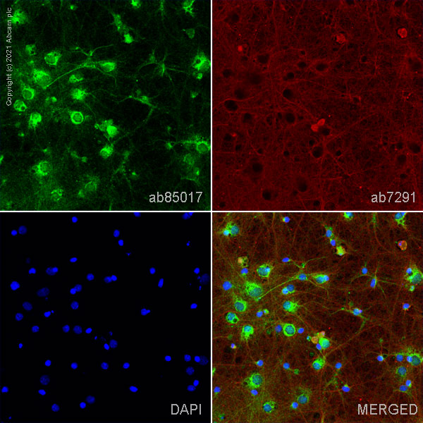 Immunocytochemistry/ Immunofluorescence - Anti-NSMase2 antibody (AB85017), expandable thumbnail