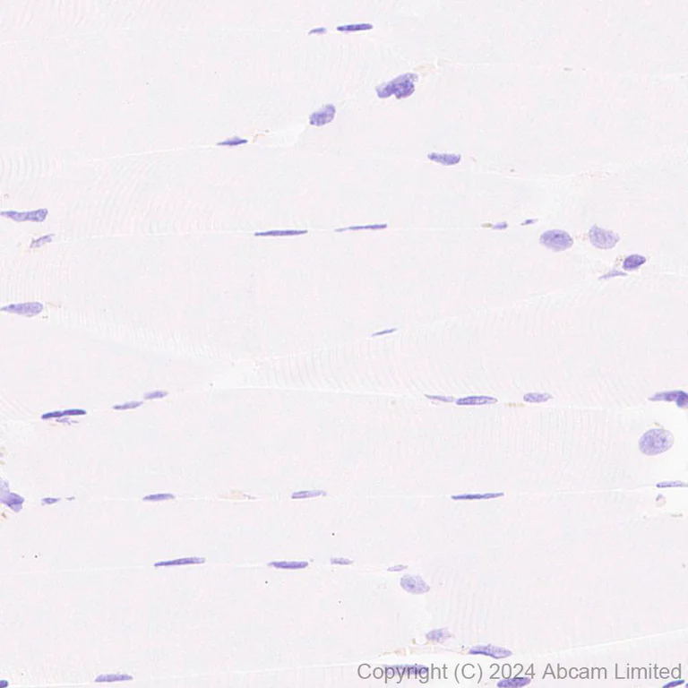 Immunohistochemistry (Formalin/PFA-fixed paraffin-embedded sections) - Anti-NSMase2 antibody [EPR29180-87] (AB322660)