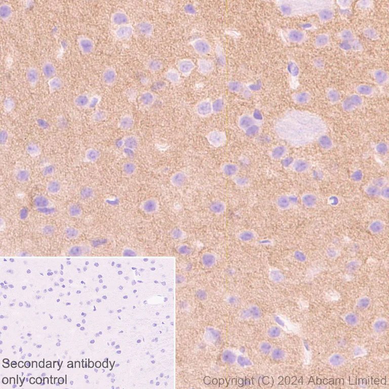 Immunohistochemistry (Formalin/PFA-fixed paraffin-embedded sections) - Anti-NSMase2 antibody [EPR29180-87] - BSA and Azide free (AB325962)