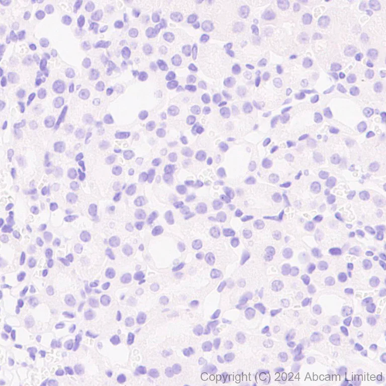 Immunohistochemistry (Formalin/PFA-fixed paraffin-embedded sections) - Anti-NSMase2 antibody [EPR29180-87] - BSA and Azide free (AB325962)