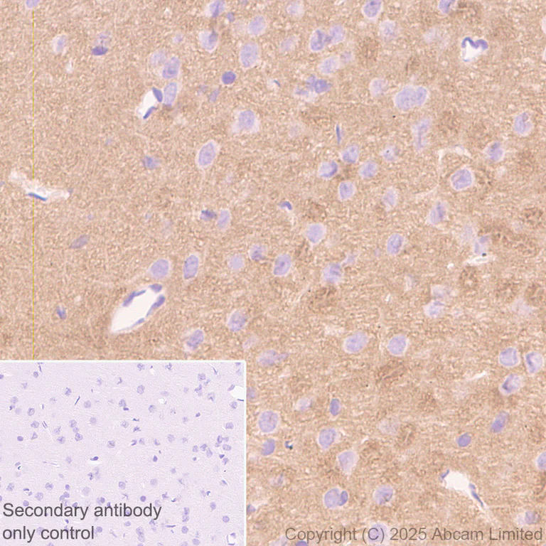 Immunohistochemistry (Formalin/PFA-fixed paraffin-embedded sections) - Anti-NSMase2 antibody [EPR29180-87] - BSA and Azide free (AB325962)