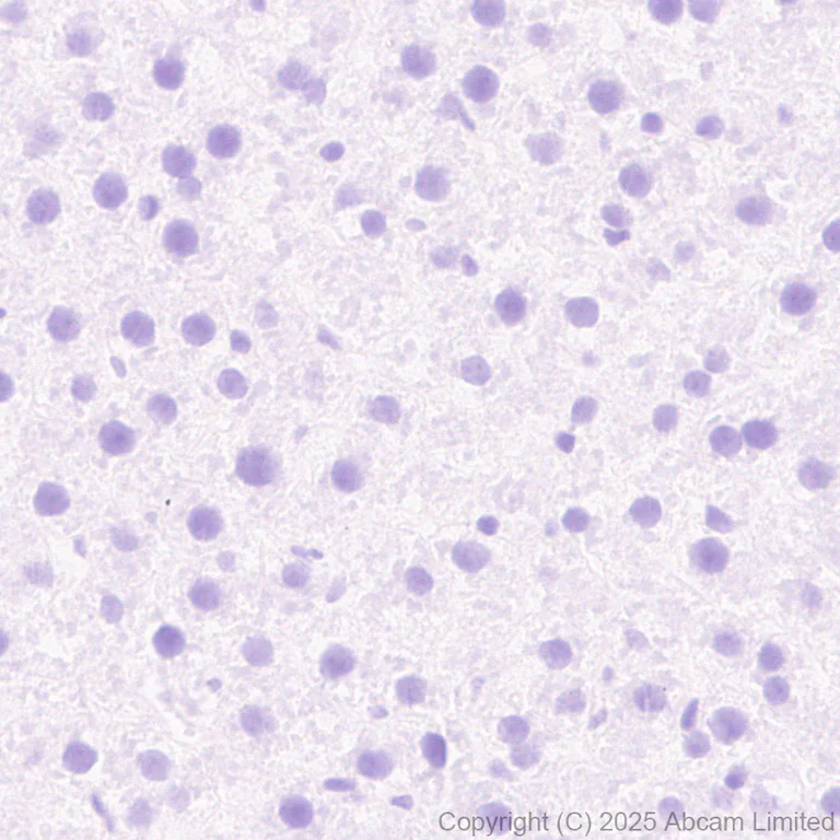 Immunohistochemistry (Formalin/PFA-fixed paraffin-embedded sections) - Anti-NSMase2 antibody [EPR29180-87] - BSA and Azide free (AB325962)