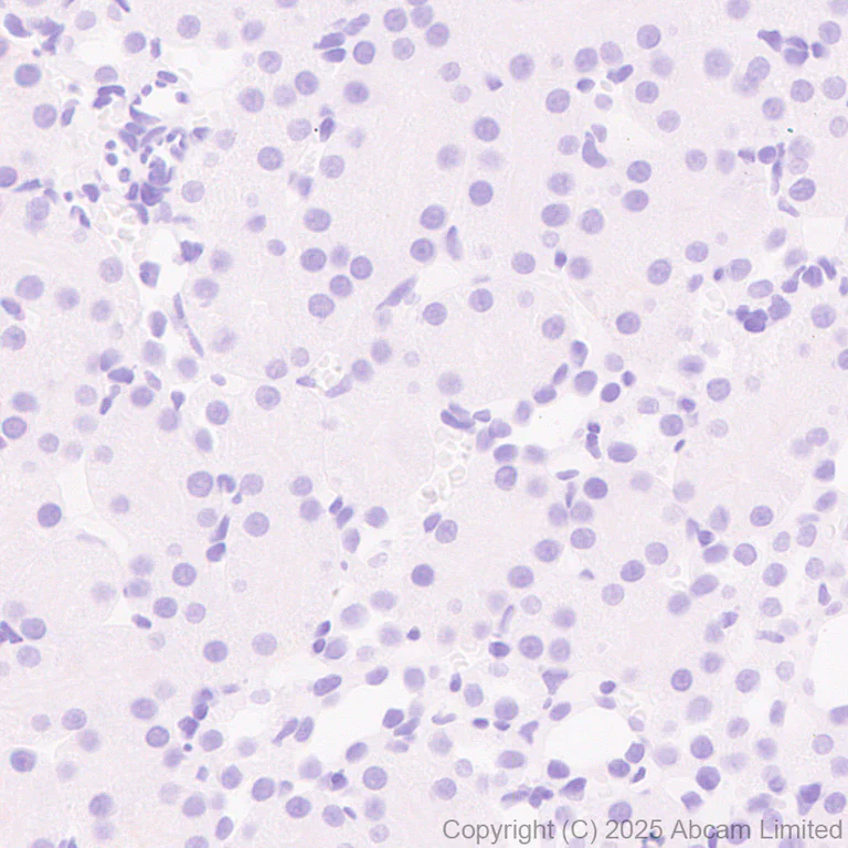 Immunohistochemistry (Formalin/PFA-fixed paraffin-embedded sections) - Anti-NSMase2 antibody [EPR29180-87] - BSA and Azide free (AB325962)