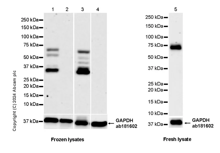 Western blot - Anti-NSMase2 antibody [EPR29180-87] - BSA and Azide free (AB325962)