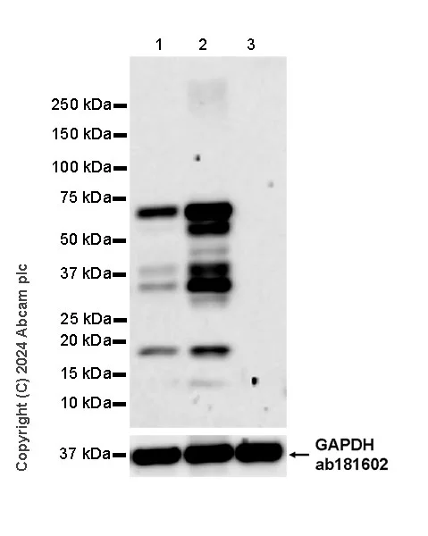 Western blot - Anti-NSMase2 antibody [EPR29180-87] - BSA and Azide free (AB325962)