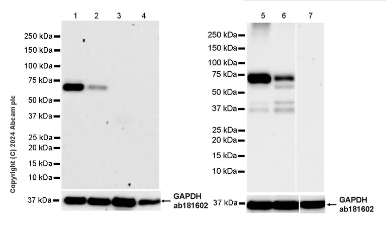 Western blot - Anti-NSMase2 antibody [EPR29180-87] - BSA and Azide free (AB325962)