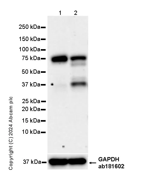 Western blot - Anti-NSMase2 antibody [EPR29180-87] - BSA and Azide free (AB325962)