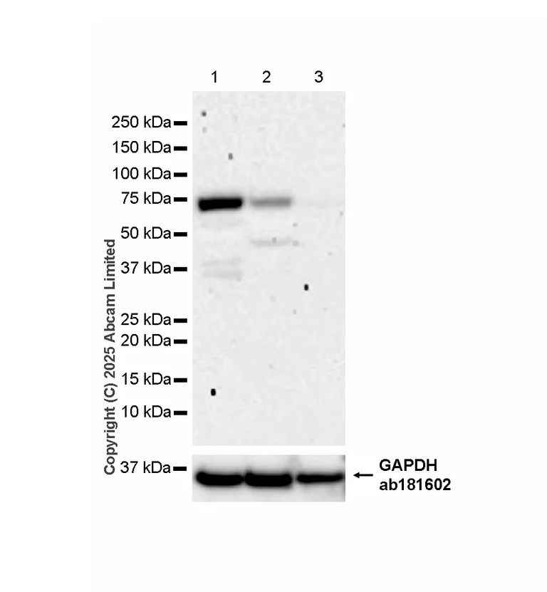 Western blot - Anti-NSMase2 antibody [EPR29180-87] - BSA and Azide free (AB325962)