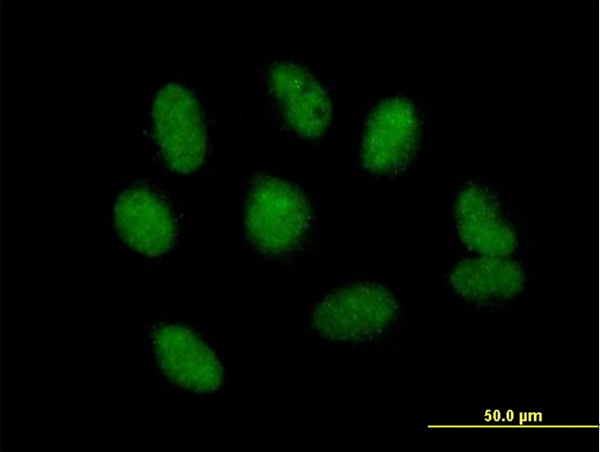 Immunocytochemistry/ Immunofluorescence - Anti-NSMCE1 antibody (AB168578), expandable thumbnail