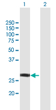 Western blot - Anti-NSMCE1 antibody (AB168578), expandable thumbnail