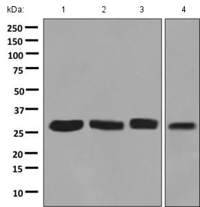 Western blot - Anti-NSMCE1 antibody [EPR9103(B)] (AB139689)