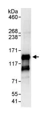 Immunoprecipitation - Anti-NSP 5 alpha 3 alpha antibody (AB87801)