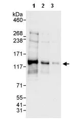 Western blot - Anti-NSP 5 alpha 3 alpha antibody (AB87801)