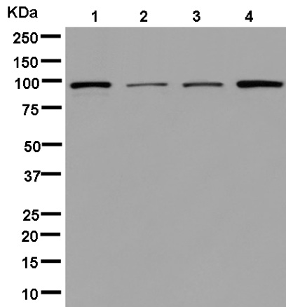 Western blot - Anti-NSP3 antibody [EPR13493] (AB181246)