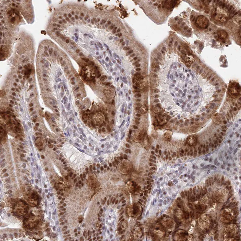 Immunohistochemistry (Formalin/PFA-fixed paraffin-embedded sections) - Anti-NSUN2/SAKI antibody (AB272624)