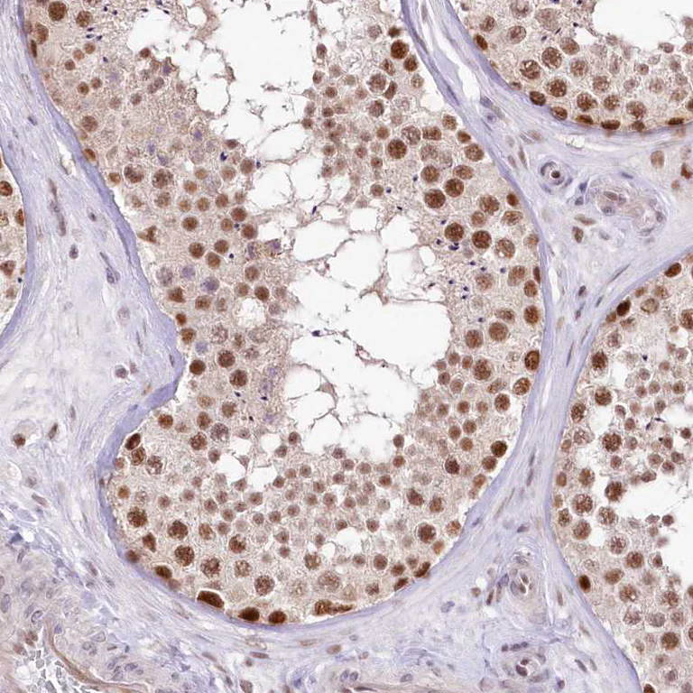 Immunohistochemistry (Formalin/PFA-fixed paraffin-embedded sections) - Anti-NSUN2/SAKI antibody (AB272624)