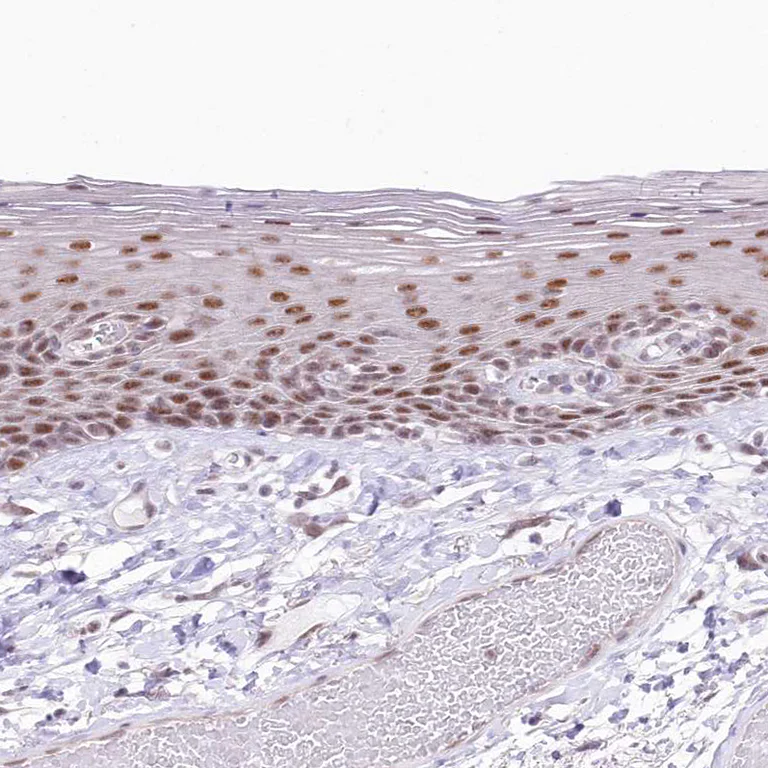 Immunohistochemistry (Formalin/PFA-fixed paraffin-embedded sections) - Anti-NSUN2/SAKI antibody (AB272624)