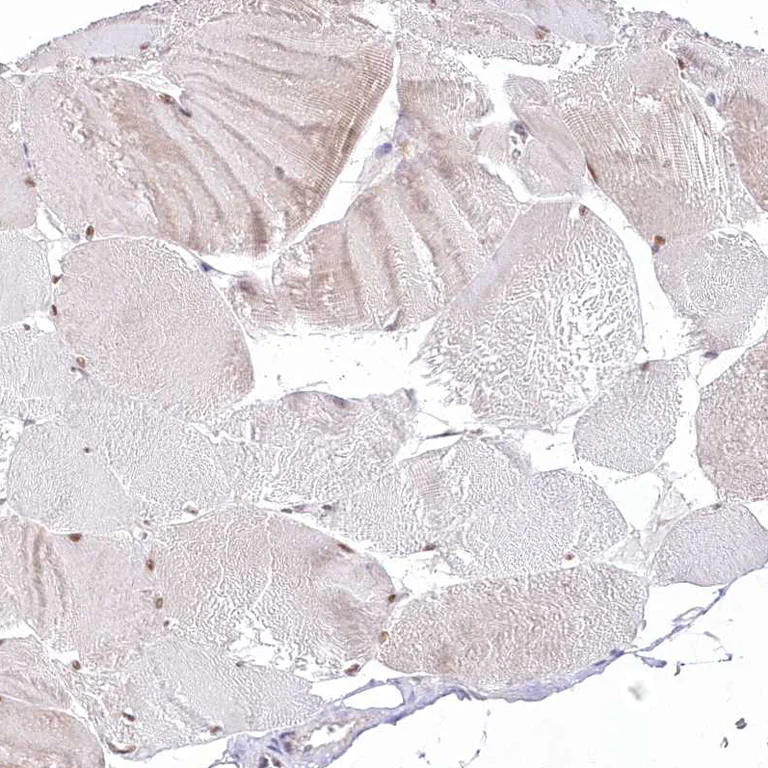 Immunohistochemistry (Formalin/PFA-fixed paraffin-embedded sections) - Anti-NSUN2/SAKI antibody (AB272624)
