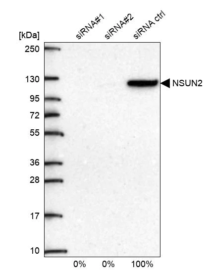 Western blot - Anti-NSUN2/SAKI antibody (AB272624)
