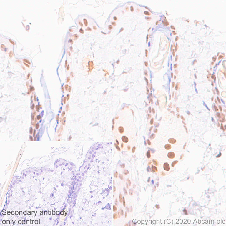 Immunohistochemistry (Formalin/PFA-fixed paraffin-embedded sections) - Anti-NSUN2/SAKI antibody [EPR24140-93] (AB259941)