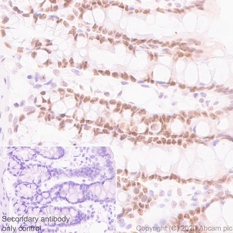 Immunohistochemistry (Formalin/PFA-fixed paraffin-embedded sections) - Anti-NSUN2/SAKI antibody [EPR24140-93] (AB259941)