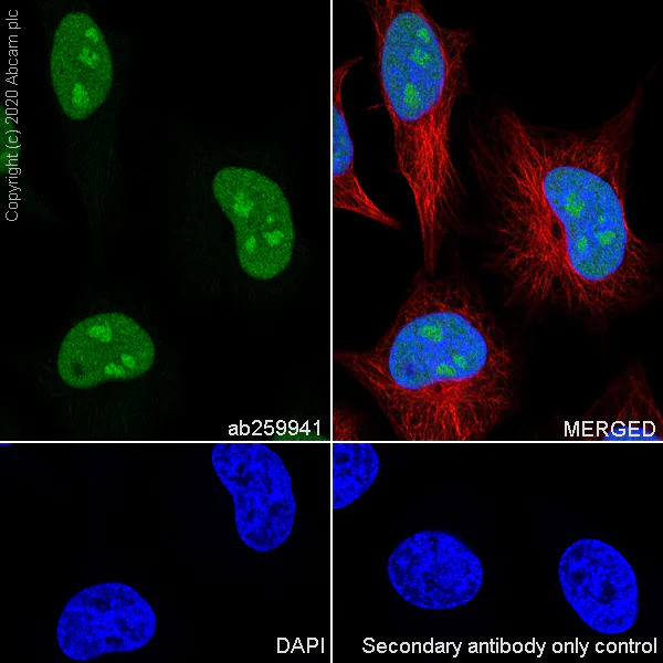 Immunocytochemistry/ Immunofluorescence - Anti-NSUN2/SAKI antibody [EPR24140-93] - BSA and Azide free (AB277534)